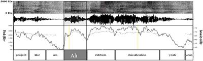 Multimodal Irregular Self-Selection in Chinese Postgraduate English as a Foreign Language Learners’ Conversation: When, How, and Why